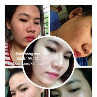 Bạch Hồng Đơn đông y