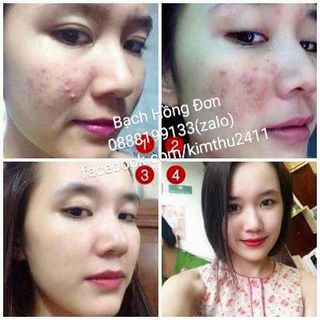 Bạch Hồng Đơn đông y