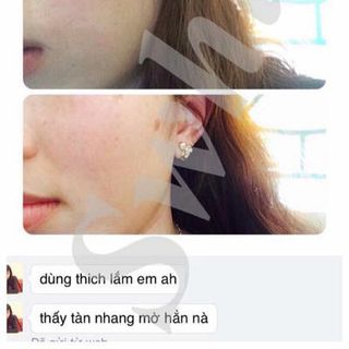 Kem Trị Nám Tàn Nhang Đồi mồi SWHITE