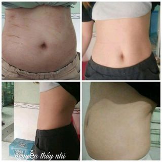 CAO LÁ RỪNG ZN cao plus