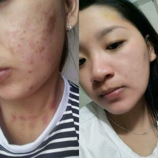 Serum Hồng Sâm Nicky- Ngừa nám tàn nhan chống lão hoá dưỡng trắng se lỗ chân lông