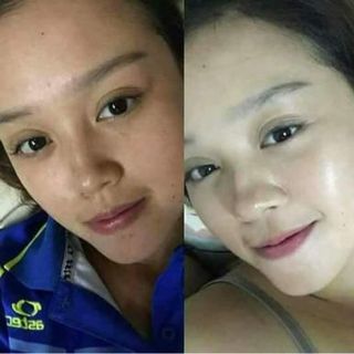 Serum Hồng Sâm Nicky- Ngừa nám tàn nhan chống lão hoá dưỡng trắng se lỗ chân lông
