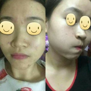Serum Hồng Sâm Nicky- Ngừa nám tàn nhan chống lão hoá dưỡng trắng se lỗ chân lông