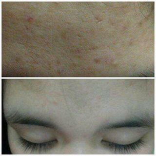 Serum Hồng Sâm Nicky- Ngừa nám tàn nhan chống lão hoá dưỡng trắng se lỗ chân lông