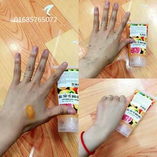 GEL TẨY TẾ BÀO CHẾT VÀ BODY 200GR