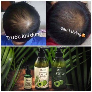 Compo dầu gội organic Amla giá sỉ