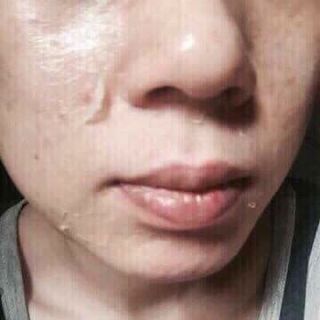 Lột tái tạo da Peel Perfect - Nhật Bản