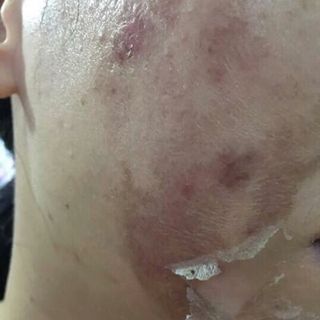 Lột tái tạo da Peel Perfect - Nhật Bản