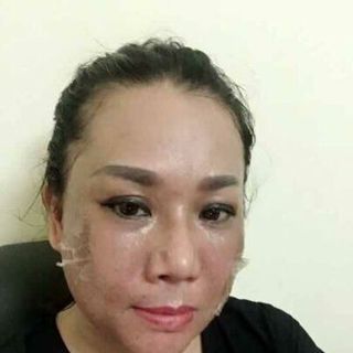 Lột tái tạo da Peel Perfect - Nhật Bản
