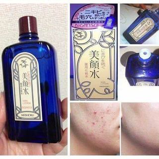 nước hoa hồng trị mụn Nhật Bản