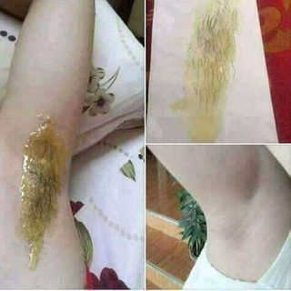 Combo Bộ 2 Mỡ Trăn Wax Veo