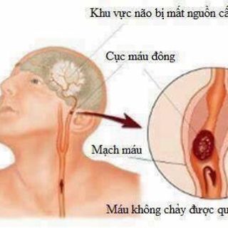 An Cung Ngưu Hoàng Hoàn KOREA