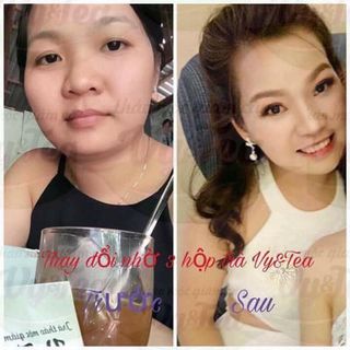 trà thảo mộc giảm cân Vytea