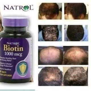 Viên Uống mọc tóc Natrol Biotin hàng về