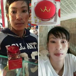 Nữ Hoàng trị thâm nám tàn nhang BellLrocre