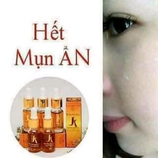 Serum Kiều auth 100