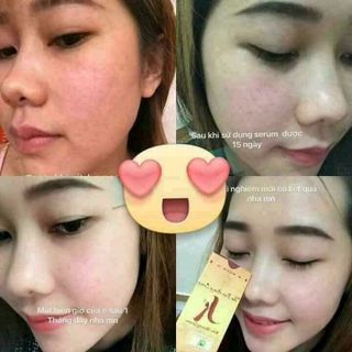Serum Kiều auth 100