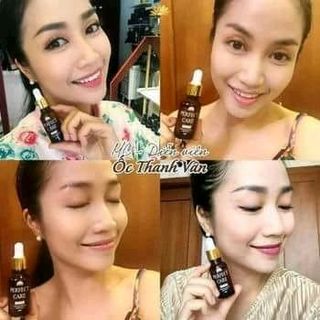 serum ốc sên PERFECT CARE auth