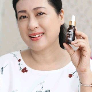 serum ốc sên PERFECT CARE auth