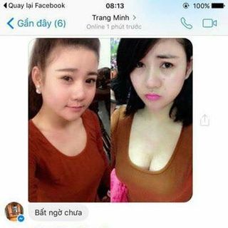 TINH DẦU NỞ NGỰC