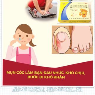 Miếng dán mụn cóc