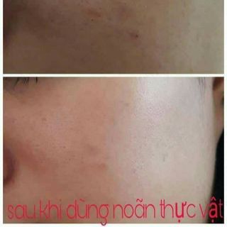 serum tinh chất noãn thực vật