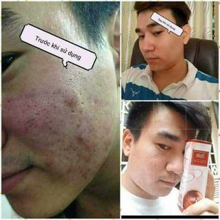 serum tinh chất noãn thực vật