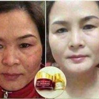 Nám magic giá sỉ