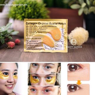 Nạ Mắt