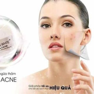 mụn spl giá sỉ