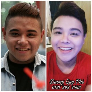 Thuốc Đông Y Trị Mụn Dương Quý Phi