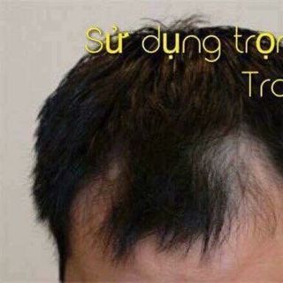 Tinh Dầu Bưởi Kích Mọc Tóc