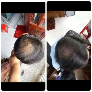 Tinh Dầu Bưởi Kích Mọc Tóc