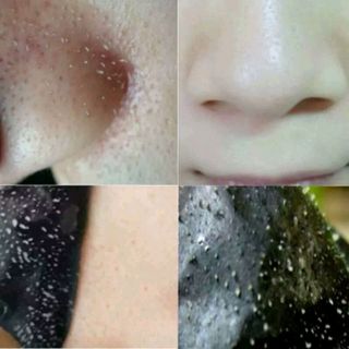 Gel lột mụn than tre trắng da