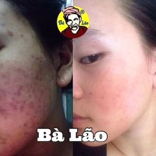 Nam Dược Bà Lão