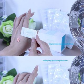 Điều trị xóa bọng mắt xóa nếp nhăn sẹo rỗ tức thì sau 2 phút