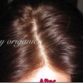 dầu gội dầu ủ thảo dược trị rụng tóc