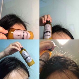 Xịt tóc thuốc Bắc kích mọc tóc trị tụng tóc