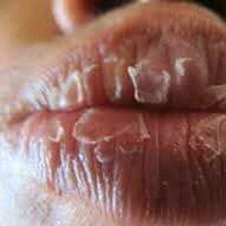 SON DƯỠNG GẤC TRỊ THÂM LÀM HỒNG MÔI