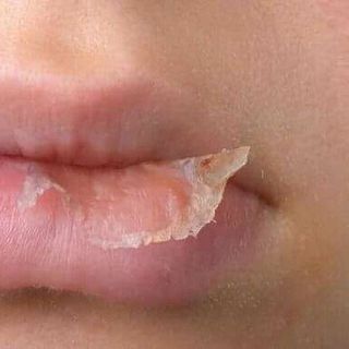 SON DƯỠNG GẤC TRỊ THÂM LÀM HỒNG MÔI