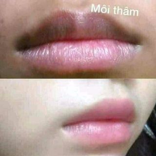 SON DƯỠNG GẤC TRỊ THÂM LÀM HỒNG MÔI