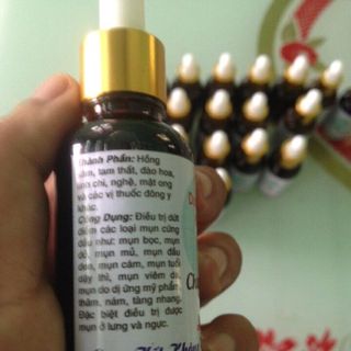 Thuốc trị mụn Đông Y