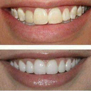 bột thảo dược trắng răng