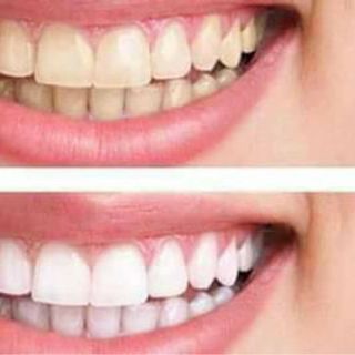 bột thảo dược trắng răng