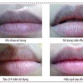 HỒNG NHŨ HOA MÔI giá sỉ