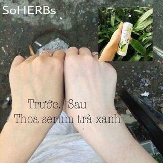 Serum Body SoHERBs