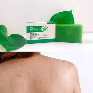 Soap Body Acnes giá sỉ
