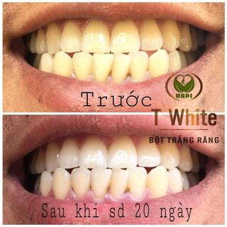 Bột Trắng Răng T-White