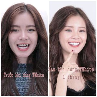 bột trắng răng TWHITE