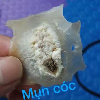 Sỉ thuốc trị mụn cơm mụn cóc mắc cá chân acid trichloracetic 80